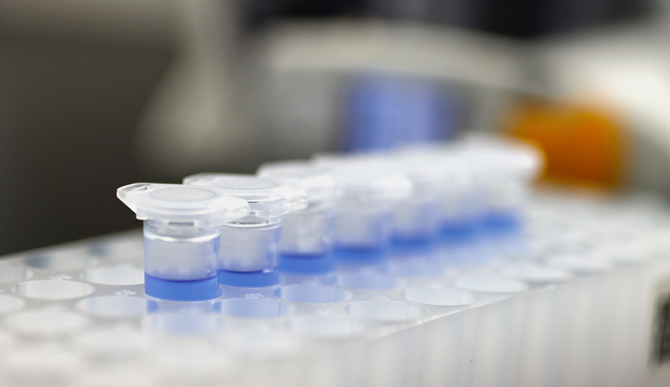 オーダーメイド測定